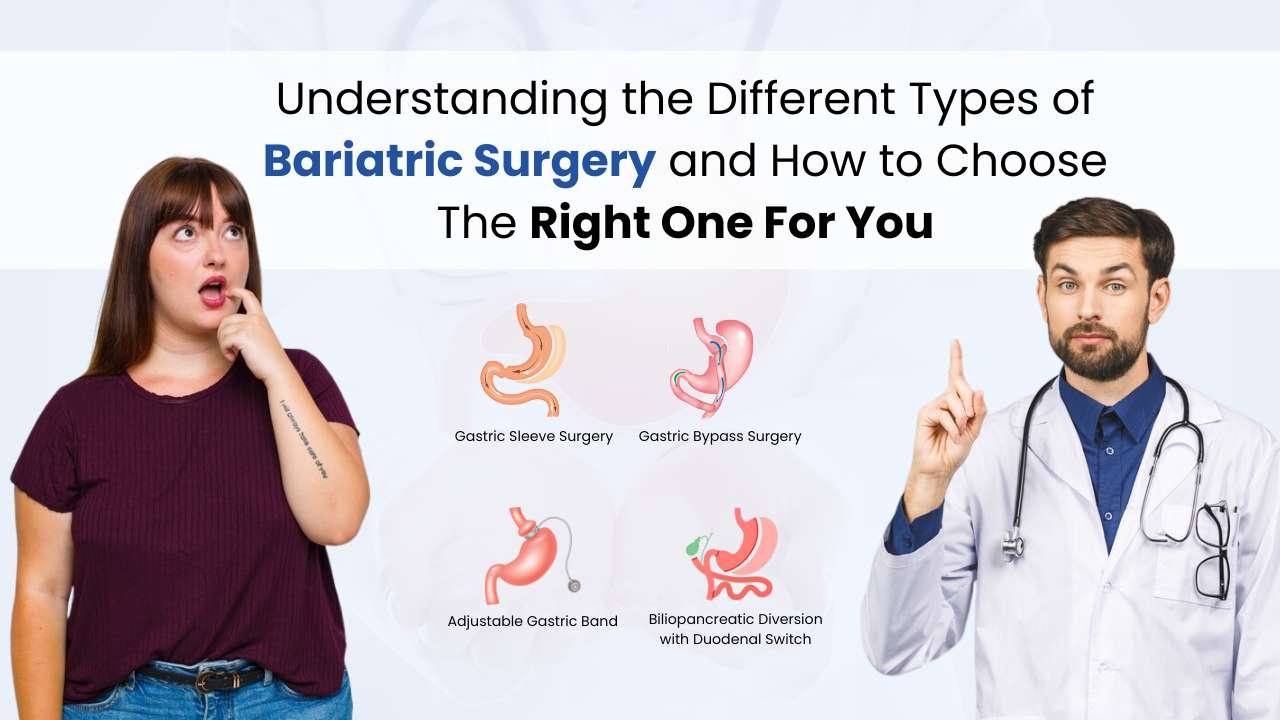 Understanding the Different Types of Bariatric Surgery and How to Choose The Right One For You